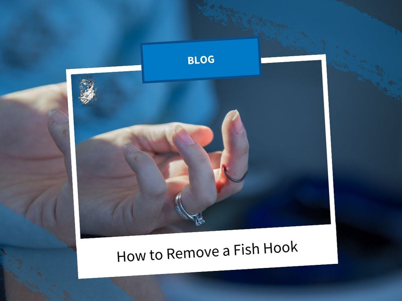 How to Remove a Fish Hook